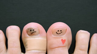 Laser Fungal Nail Treatment | Bishops Cleeve Cheltenham