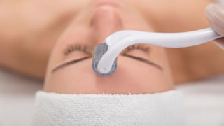 Microneedling | Bishops Cleeve Cheltenham Microneedling | Bishops Cleeve Cheltenham