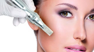 Microneedling | Bishops Cleeve Cheltenham